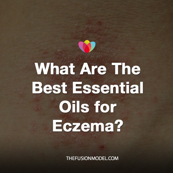 What Are The Best Essential Oils for Eczema