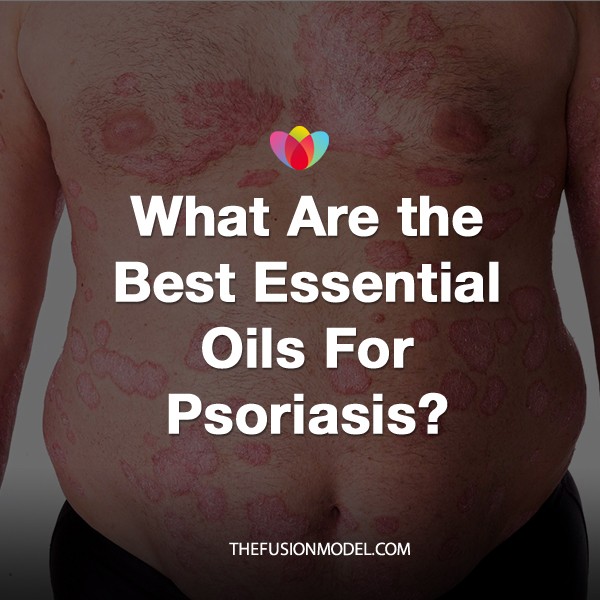 What Are the Best Essential Oils For Psoriasis?